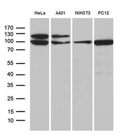 KPNB1 Monoclonal Antibody (OTI9D6), TrueMAB , OriGene 100 &mu;L; Unconjugated:Antibodies,