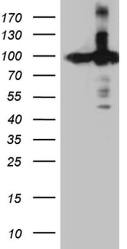 KPNB1 Monoclonal Antibody (OTI6H3), TrueMAB , OriGene:Antibodies:Primary
