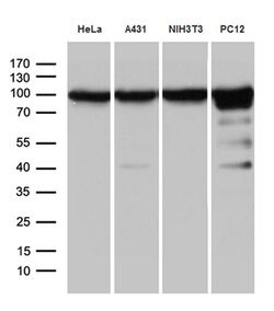 KPNB1 Monoclonal Antibody (OTI6H3), TrueMAB , OriGene 100 &mu;L; Unconjugated:Antibodies,