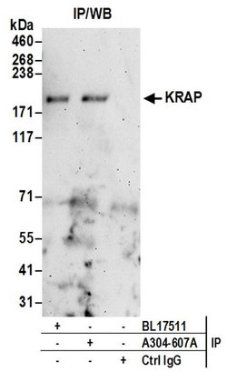 KRAP Rabbit anti-Human, Polyclonal, Bethyl Laboratories 100 &mu;L; Unconjugated:Antibodies,