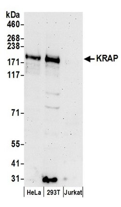 KRAP Rabbit anti-Human, Polyclonal, Bethyl Laboratories 100 &mu;L; Unconjugated:Antibodies,