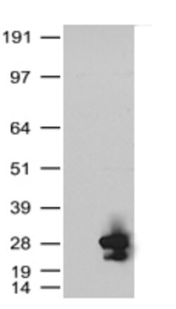 KRAS Mouse anti-Human, Clone: OTI2C1, lyophilized, TrueMAB 100 &mu;g; Unconjugated:Antibodies,