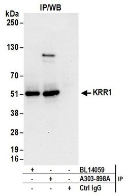 KRR1 Rabbit anti-Human, Polyclonal, Bethyl Laboratories 100 &mu;L; Unconjugated:Antibodies,