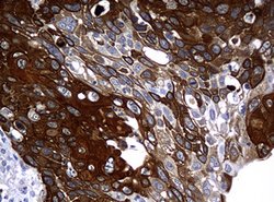 KRT14 Mouse anti-Human, Clone: OTI3C7, lyophilized, TrueMAB 100 &mu;g;