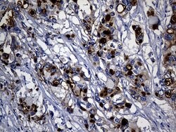 KRT14 Mouse anti-Human, Clone: OTI5F2, lyophilized, TrueMAB 100 &mu;g;