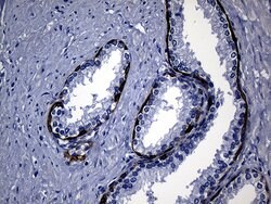 KRT14 Mouse anti-Human, Clone: OTI5F2, lyophilized, TrueMAB 100 &mu;g;