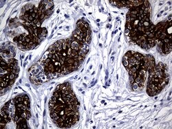 KRT14 Mouse anti-Human, Clone: OTI5F2, lyophilized, TrueMAB 100 &mu;g;