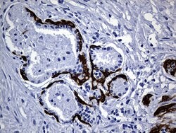 KRT14 Mouse anti-Human, Clone: OTI5F2, lyophilized, TrueMAB 100 &mu;g;
