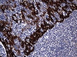 KRT14 Mouse anti-Human, Clone: OTI5F2, lyophilized, TrueMAB 100 &mu;g;