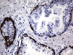 KRT14 Monoclonal Antibody (OTI4A7), TrueMAB , OriGene 30 &mu;L; Unconjugated:Antibodies,