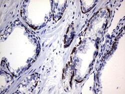 KRT14 Monoclonal Antibody (OTI4A7), TrueMAB , OriGene 30 &mu;L; Unconjugated:Antibodies,