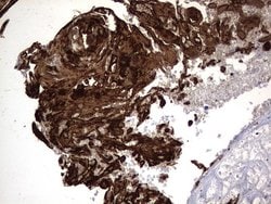 KRT14 Monoclonal Antibody (OTI4A7), TrueMAB , OriGene 30 &mu;L; Unconjugated:Antibodies,