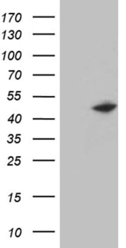 KRT14 Mouse anti-Human, Clone: OTI3C7, lyophilized, TrueMAB 100 &mu;g;