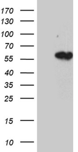 KRT14 Mouse anti-Human, Clone: OTI5F2, lyophilized, TrueMAB 100 &mu;g;
