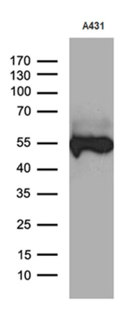 KRT14 Mouse anti-Human, Clone: OTI5F2, lyophilized, TrueMAB 100 &mu;g;