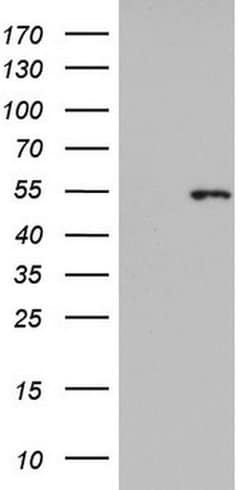 KRT14 Monoclonal Antibody (OTI4A7), TrueMAB , OriGene 30 &mu;L; Unconjugated:Antibodies,