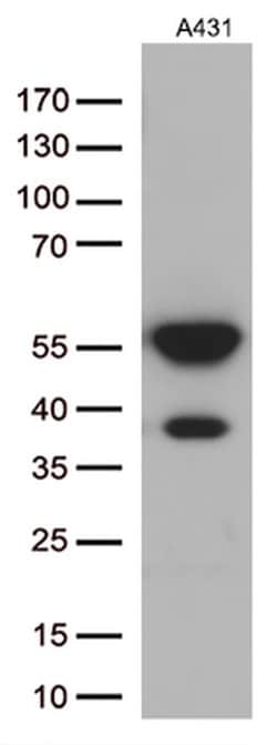 KRT14 Monoclonal Antibody (OTI4A7), TrueMAB , OriGene 30 &mu;L; Unconjugated:Antibodies,