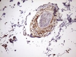 KRT16 Monoclonal Antibody (OTI6A11), TrueMAB , OriGene 100 &mu;L; Unconjugated:Antibodies,