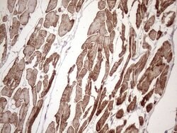 KRT16 Monoclonal Antibody (OTI6A11), TrueMAB , OriGene 100 &mu;L; Unconjugated:Antibodies,