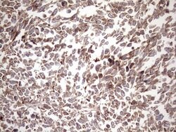 KRT16 Monoclonal Antibody (OTI6A11), TrueMAB , OriGene 100 &mu;L; Unconjugated:Antibodies,