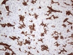 KRT16 Monoclonal Antibody (OTI2H8), TrueMAB , OriGene 30 &mu;L | Buy Online | Origene Technologies | Fisher Scientific