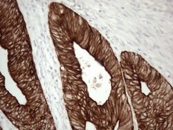 KRT16 Monoclonal Antibody (OTI2H8), TrueMAB , OriGene 30 &mu;L | Buy Online | Origene Technologies | Fisher Scientific