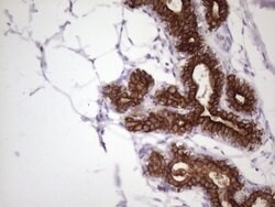 KRT16 Mouse anti-Human, Clone: OTI7A4, lyophilized, TrueMAB 100 &mu;g;