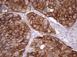KRT16 Mouse anti-Human, Clone: OTI7A4, lyophilized, TrueMAB 100 &mu;g;