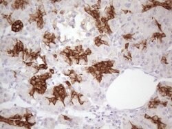 KRT16 Mouse anti-Human, Clone: OTI7A4, lyophilized, TrueMAB 100 &mu;g;