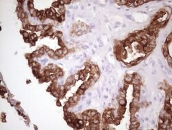KRT16 Mouse anti-Human, Clone: OTI7A4, lyophilized, TrueMAB 100 &mu;g;
