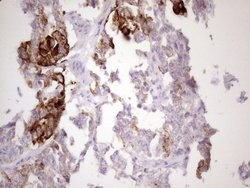 KRT16 Mouse anti-Human, Clone: OTI7A4, lyophilized, TrueMAB 100 &mu;g;