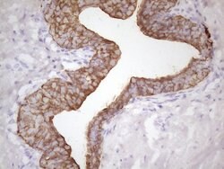 KRT16 Mouse anti-Human, Clone: OTI7A4, lyophilized, TrueMAB 100 &mu;g;