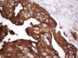 KRT16 Mouse anti-Human, Clone: OTI7A4, lyophilized, TrueMAB 100 &mu;g;