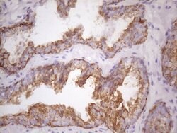KRT16 Mouse anti-Human, Clone: OTI7A4, lyophilized, TrueMAB 100 &mu;g;