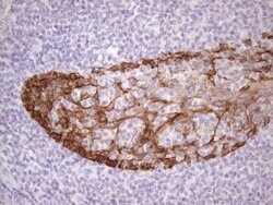 KRT16 Mouse anti-Human, Clone: OTI7A4, lyophilized, TrueMAB 100 &mu;g;