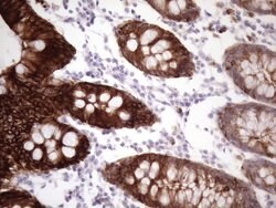 KRT16 Mouse anti-Human, Clone: OTI7A4, lyophilized, TrueMAB 100 &mu;g;
