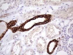 KRT16 Mouse anti-Human, Clone: OTI7A4, lyophilized, TrueMAB 100 &mu;g;
