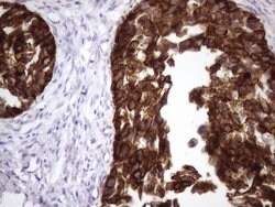 KRT16 Mouse anti-Human, Clone: OTI7A4, lyophilized, TrueMAB 100 &mu;g;