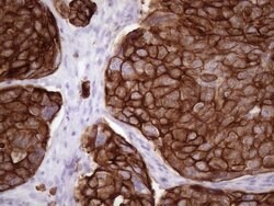 KRT16 Mouse anti-Human, Clone: OTI1G5, lyophilized, TrueMAB 100 &mu;g;