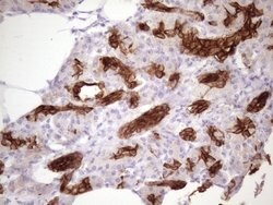 KRT16 Mouse anti-Human, Clone: OTI1G5, lyophilized, TrueMAB 100 &mu;g;