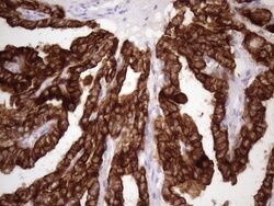 KRT16 Mouse anti-Human, Clone: OTI1G5, lyophilized, TrueMAB 100 &mu;g;