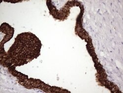 KRT16 Mouse anti-Human, Clone: OTI1G5, lyophilized, TrueMAB 100 &mu;g;