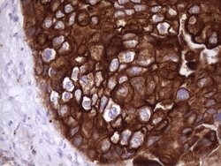 KRT16 Mouse anti-Human, Clone: OTI1G5, lyophilized, TrueMAB 100 &mu;g;