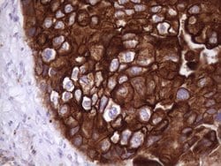 KRT16 Monoclonal Antibody (OTI1G5), TrueMAB , OriGene 100 &mu;L; Unconjugated:Antibodies,