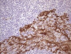 KRT16 Mouse anti-Human, Clone: OTI1G5, lyophilized, TrueMAB 100 &mu;g;