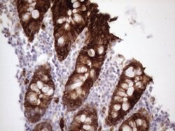 KRT16 Mouse anti-Human, Clone: OTI1G5, lyophilized, TrueMAB 100 &mu;g;