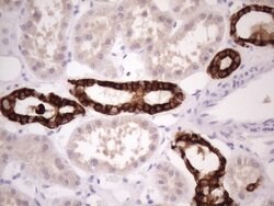 KRT16 Mouse anti-Human, Clone: OTI1G5, lyophilized, TrueMAB 100 &mu;g;