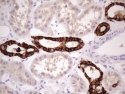 KRT16 Monoclonal Antibody (OTI1G5), TrueMAB , OriGene 100 &mu;L; Unconjugated:Antibodies,