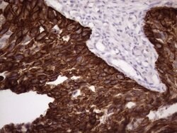 KRT16 Mouse anti-Human, Clone: OTI1G5, lyophilized, TrueMAB 100 &mu;g;