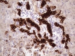 KRT16 Mouse anti-Human, Clone: OTI1G5, lyophilized, TrueMAB 100 &mu;g;